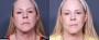 Dr. Roark Neck Lift Patient 5