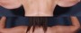 Dr. Saltz Upper Arm Lift Patient 2